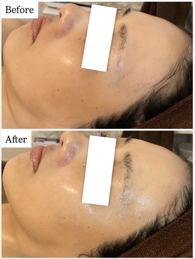 施術事例 Before After